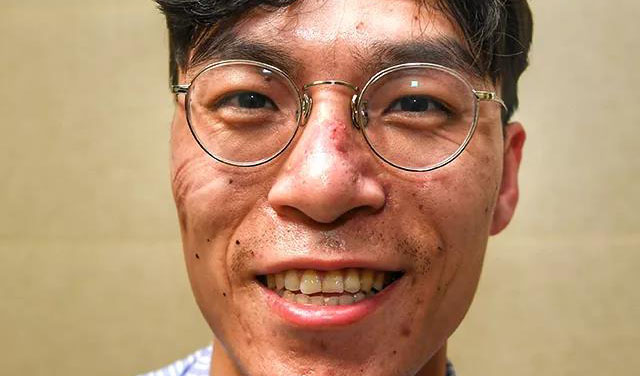 這些刻在我們臉上的印痕，會成為永恒的記憶！